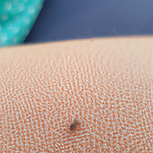 The Dangers of Flea Bites on Clothes and Skin