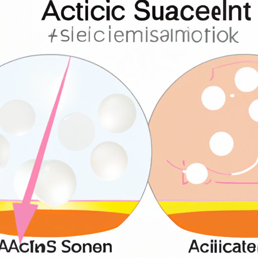 A Comparison of Salicylic Acid and Other Acne Treatments
