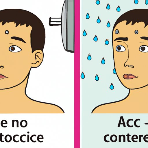 The Pros and Cons of Cold Showers for Acne Sufferers
