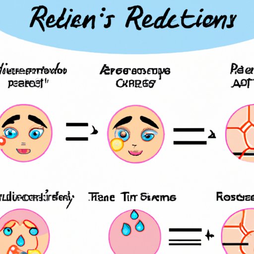 How Retinoids Work to Reduce Acne Symptoms