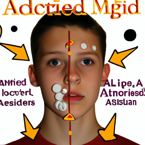 Exploring the Link Between Adderall and Acne
