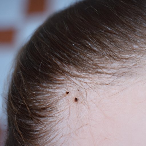 The Truth Behind Lice and Clean Hair