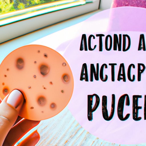 Acne Patches: What You Need to Know About Their Functioning