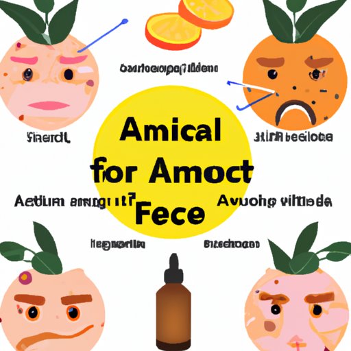 Natural Remedies to Combat Acne Breakouts