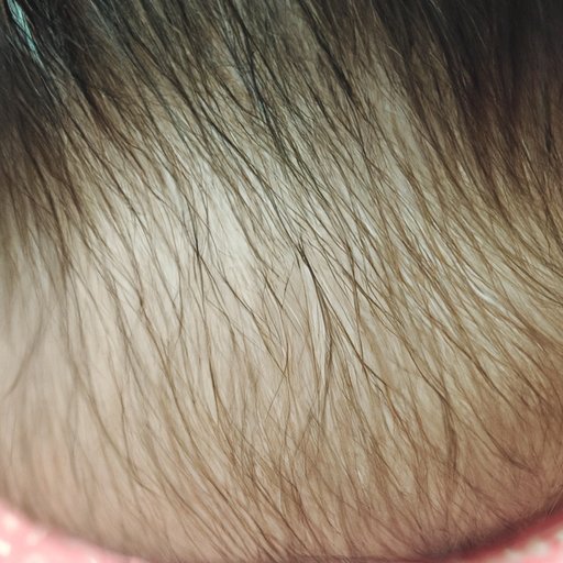 Unveiling the Mystery of How Many Hair Follicles Are On Our Heads