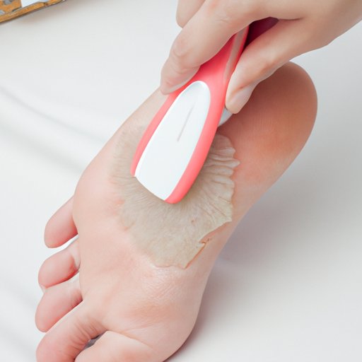 Using a Foot File or Callus Remover
