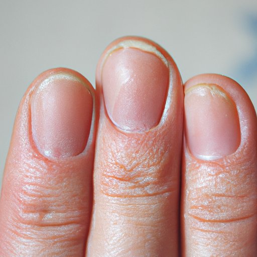 Examining the Growth Process of Fingernails