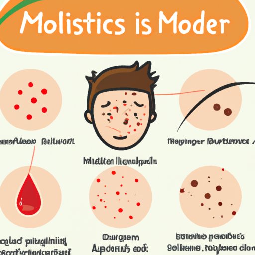 Causes and Risk Factors for Skin Moles
