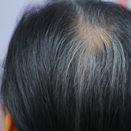 Analyzing the Impact of Stress on Hair Color: How Emotional Trauma Can Lead to White Hair
