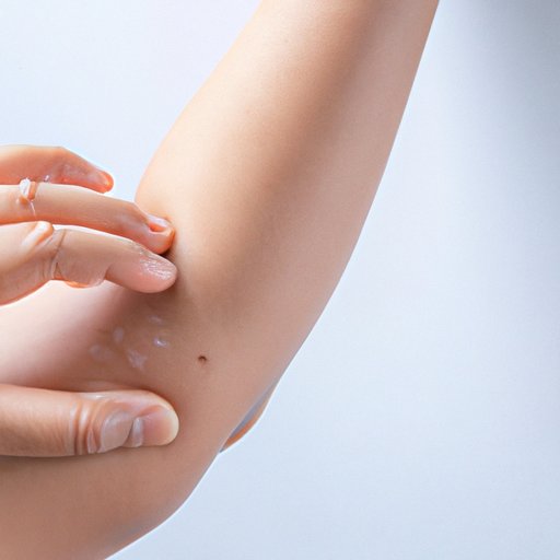 Identifying the Cause of Itchy Skin
