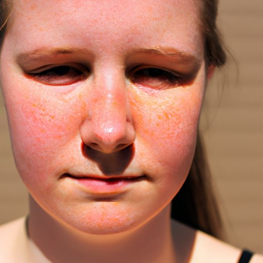 Exploring the Link between Sun Exposure and Mottled Skin