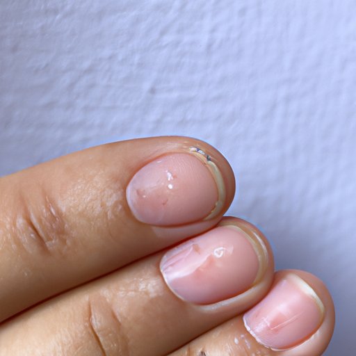 Common Causes of White Spots on Nails
