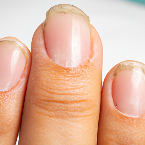 Common Conditions Affecting the Nail Bed