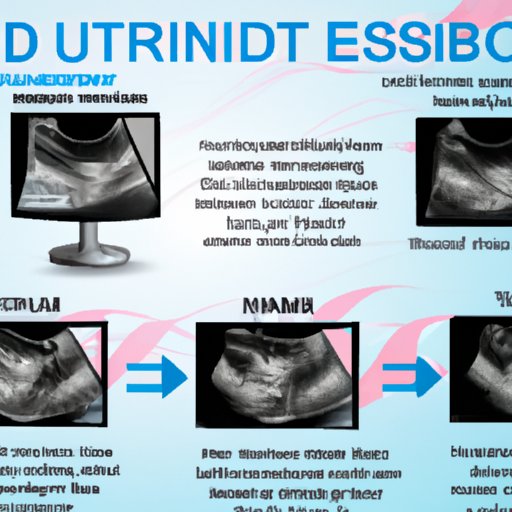 Benefits of a 4D Ultrasound 