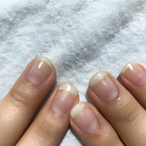 Habits that May Lead to White Nail Beds