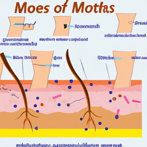 Exploring the Causes of Hair Growing from Moles