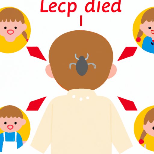 How Long Do Lice Live on Clothes? Exploring the Lifespan of Lice on Clothing