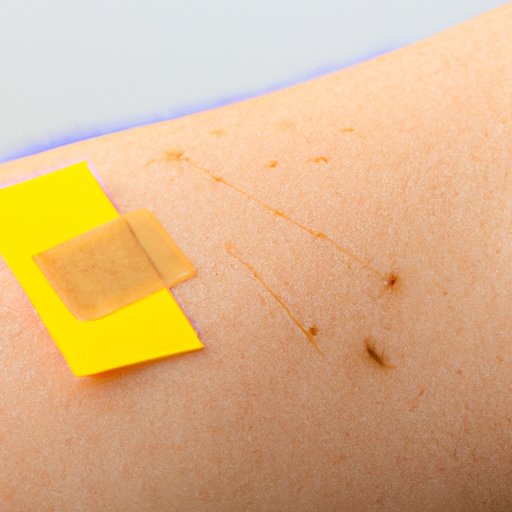 How to Safely Remove Skin Tags at Home