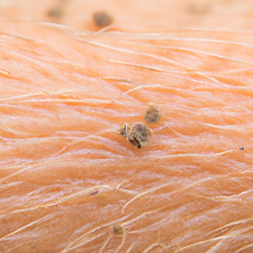How to Tell if Sand Fleas are Under Your Skin: A Comprehensive Guide