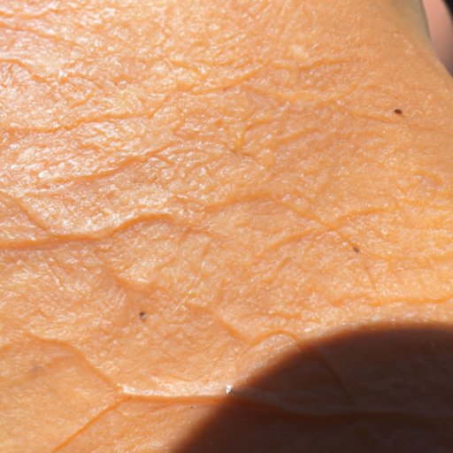 What Causes Crepe Skin? An Analysis of the Medical Perspective
