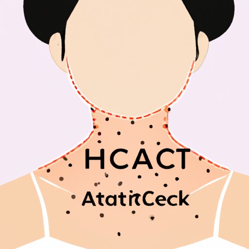 What Causes Neck Acne and How to Treat It?