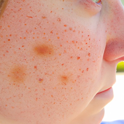 What Causes Red Spots on Skin? Exploring Common Causes and Natural Remedies