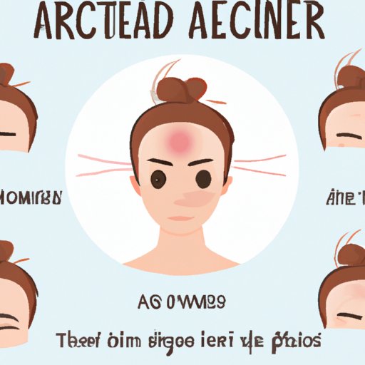 What Does Acne on Your Forehead Mean? Exploring Symptoms, Causes and Treatment Options