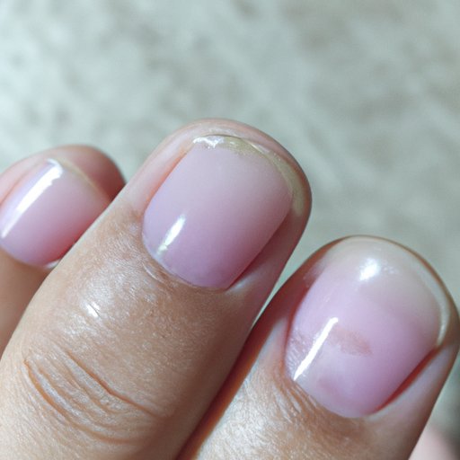 What is That White Spot on My Nail? Causes, Treatments, and Prevention Tips
