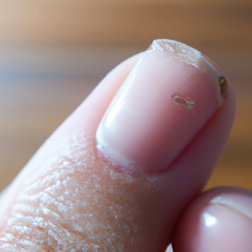 Why Do I Have a White Spot on My Nail? – Causes, Significance, and Treatment