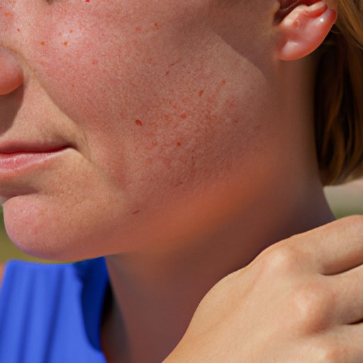 Why Does My Skin Burn? Exploring Common Causes and Treatment Options