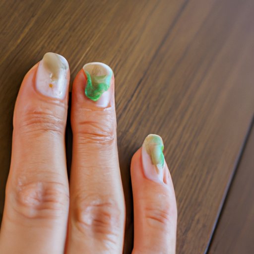 Why is My Nail Green? Causes, Treatments, and Prevention Tips
